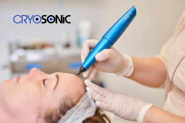 Who Is a Candidate for Cryotherapy for Actinic Keratosis