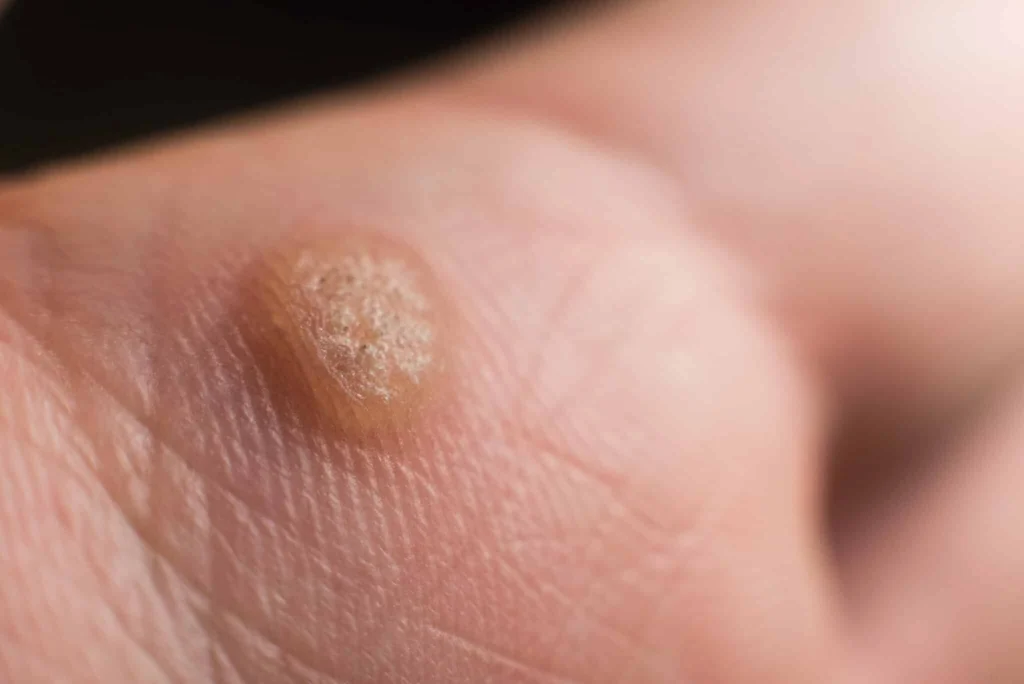 When to See a Dermatologist